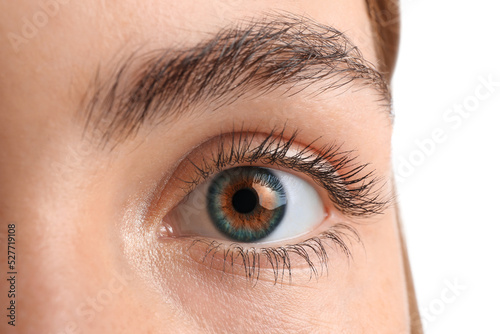 Young woman with heterochro...