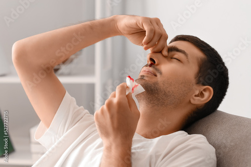 Fototapeta Naklejka Na Ścianę i Meble -  Young man with nosebleed holding tissue at home, closeup