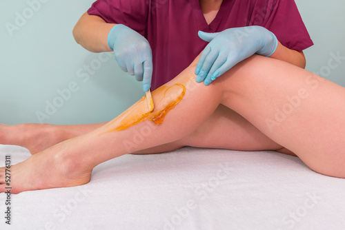 Woman undergoing leg hair removal procedure with sugaring paste in salon