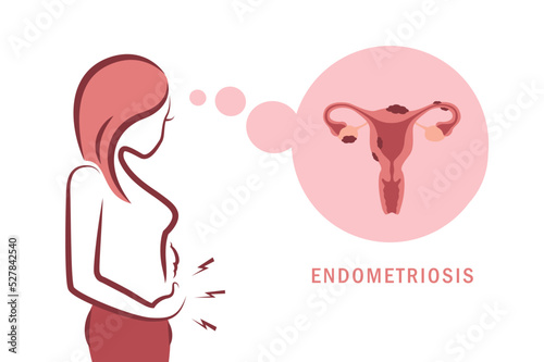 girl with endometriosis and pain womens health anatomy info graphic