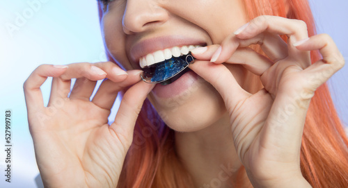 Beautiful Smiling Girl with Retainer for Teeth, Close-up