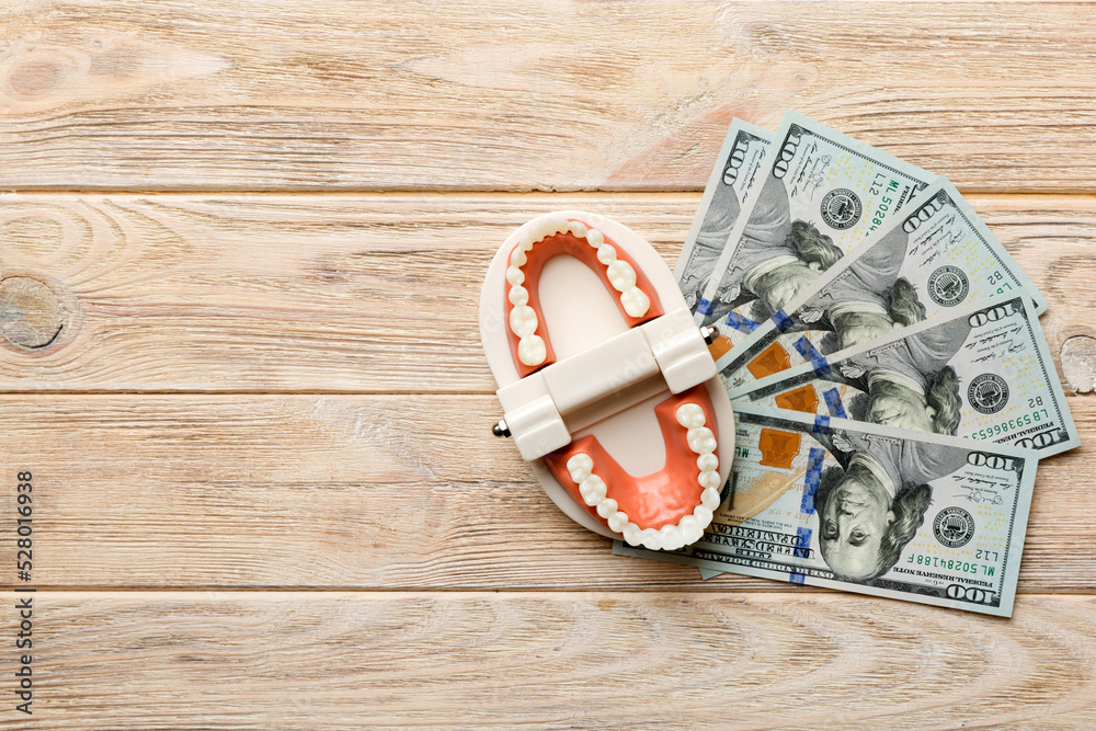 Closeup model of a human jaw with white teeth and dollar bill ...