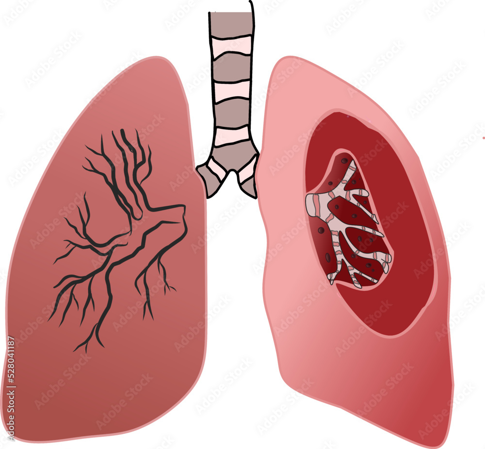 Human lung anatomy Human lung anatomy