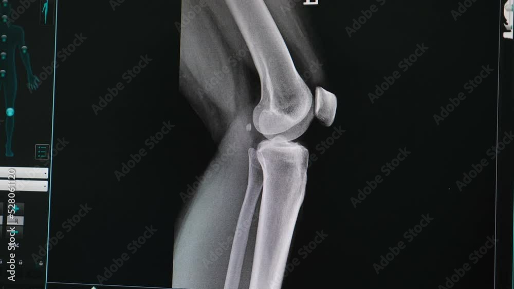 Doctor doing computer examination of knee joint using medical equipment