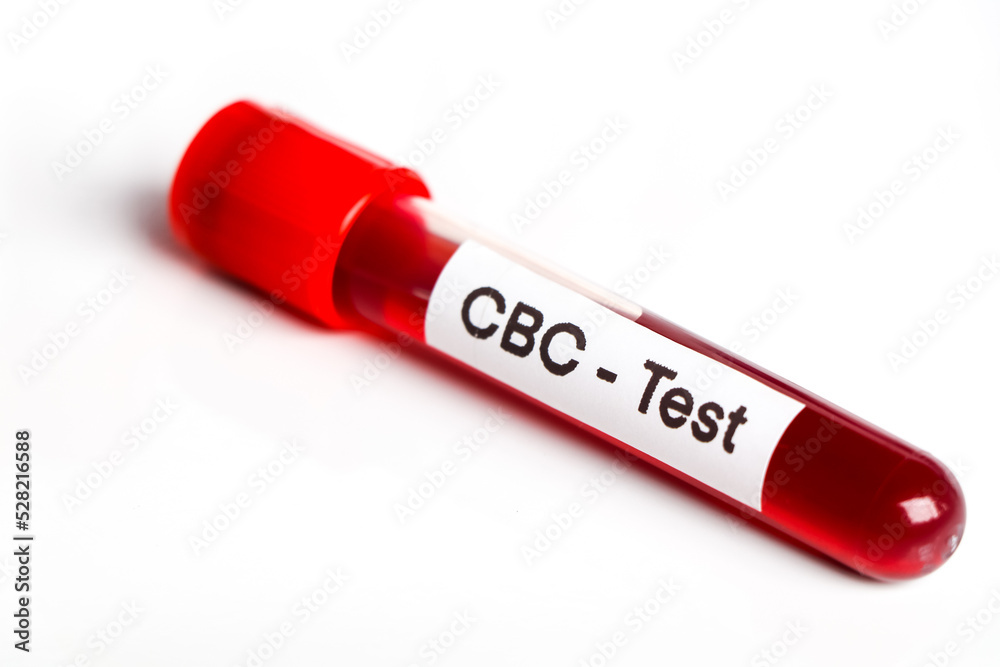 CBC test for abnormalities in red blood cells, Blood samples to be