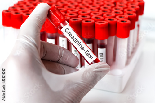 Creatinine test from blood , Blood samples to be analyzed photo