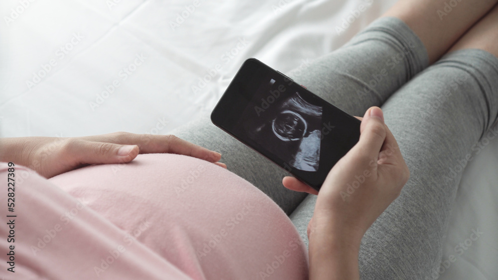 Female waiting her baby, Pregnant woman looking her ultrasound scan photo on Smartphone. Concept of pregnancy, Maternity prenatal care. Female waiting her baby, Pregnant woman looking her ultrasound scan photo on Smartphone. Concept of pregnancy, Maternity prenatal care.