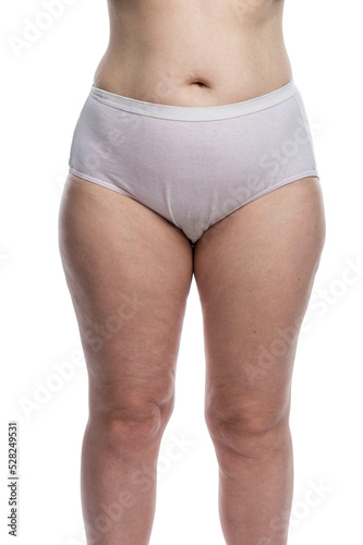 Overweight woman in ugly underwear. Obesity and self-care. Front view. Isolated on white background. Vertical.