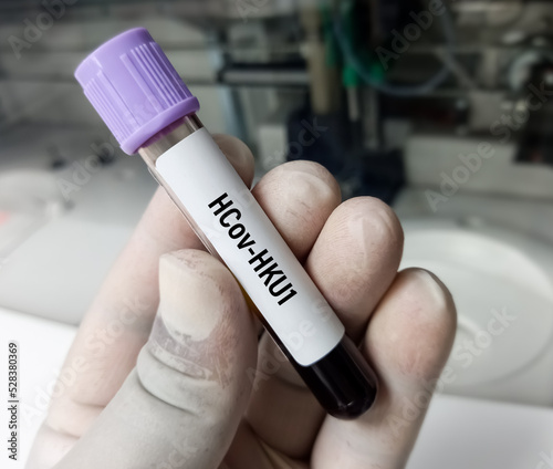 Fototapeta Naklejka Na Ścianę i Meble -  Blood sample for HCov-HKU1(Human coronavirus HKU1) test, Corona virus test.