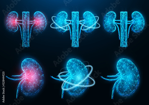Set of polygonal vector illustrations of inflamed diseased kidney, healthy kidney, and recovery of kidney functions. Urology or nephrology medical banner, template.