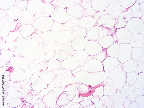 Histology of human tissue, show  epithelial tissue and connective tissue with microscope view  from the laboratory (not Illustration Designation) photo