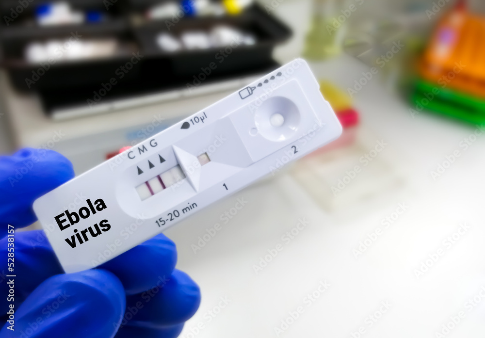 Fototapeta premium Rapid test cassette for Ebola virus test.