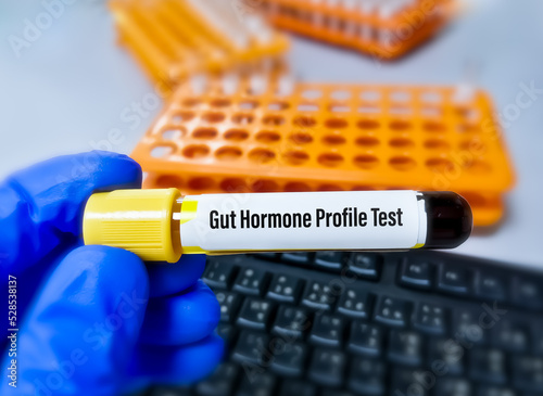 Blood sample for Gut Hormone profile test. photo