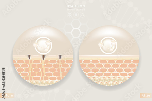 Hyaluronic acid before and after hair and skin solutions ad, white collagen serum drop into skin cells with cosmetic advertising background ready to use, illustration vector.