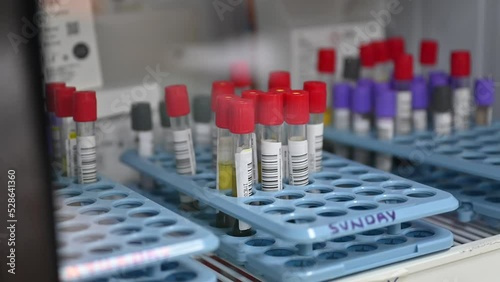 Lab sample tubes with the barcodes are stored inside the refrigerator inside the hospital Laboratory photo