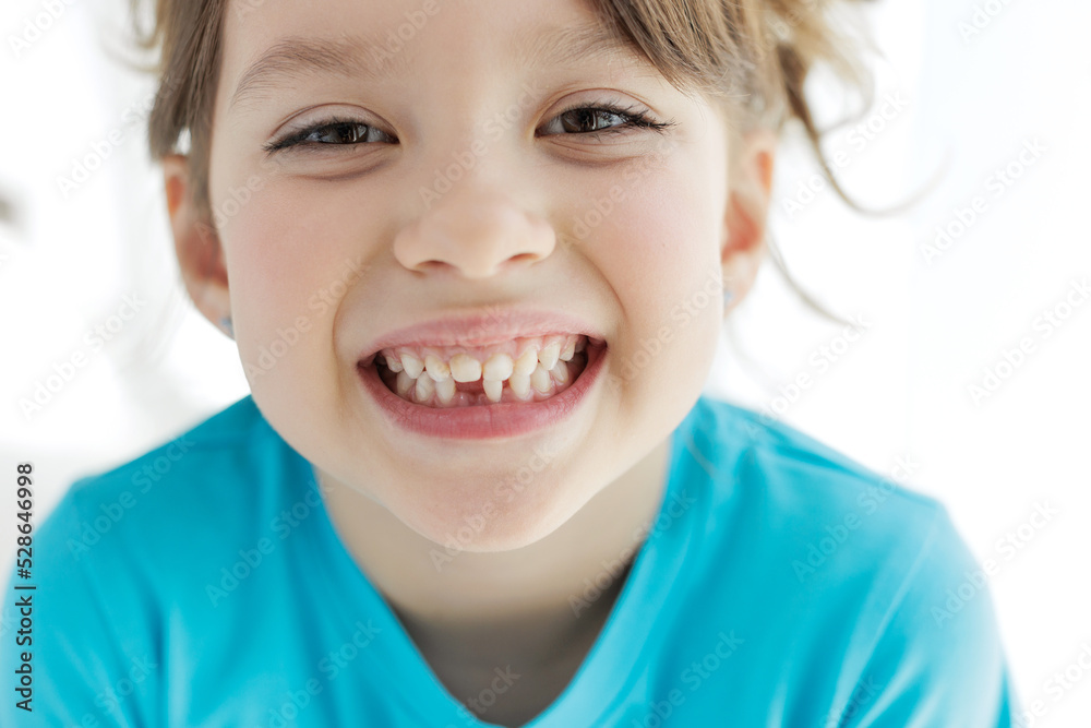 The child has lost a tooth. Little girl without a tooth. The first