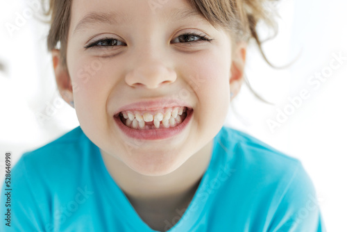 The child has lost a tooth. Little girl without a tooth. The first tooth fell out. High quality photo
