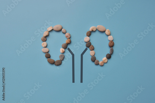 Stones on the silhouette of the kidneys. A symbol of kidney disease. Kidney stones photo
