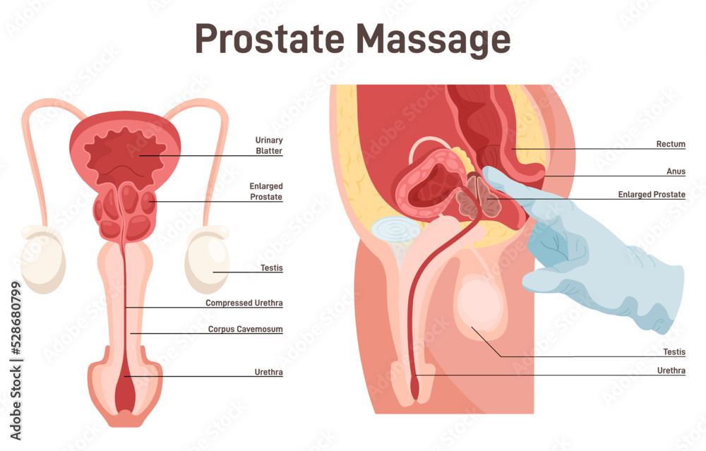 Høflig lige gjorde det Reproductive system of a man. Palpation and massage of the prostate Stock  Vector | Adobe Stock