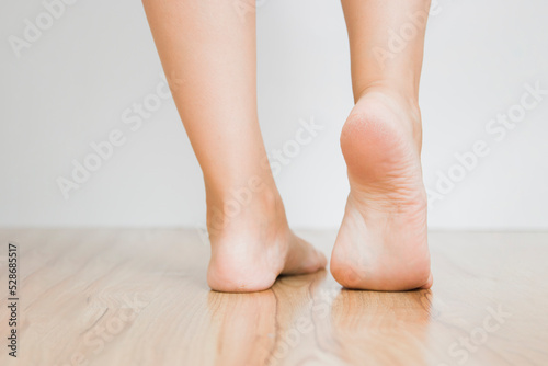 The dry skin on the heel is cracked. Closeup dehydrated skin on the heels of female feet. Treatment concept with moisturizing creams and exfoliation for healing wounds and pain when walking.
