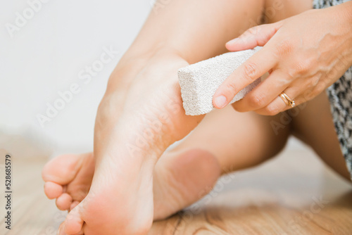 The dry skin on the heel is cracked. Closeup dehydrated skin on the heels of female feet. Treatment concept with moisturizing creams and exfoliation for healing wounds and pain when walking.