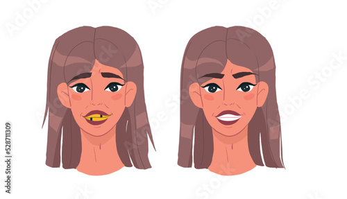 girl before and after, with an ugly smile and even white teeth. Clean teeth with mouthwash in flat design. Smiling teeth cartoon dental care. Oral healthcare with mouthwash for plaque prevention 