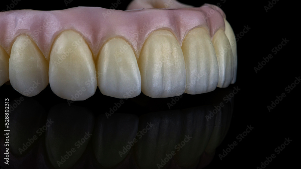 macro photo of a dental prosthesis with a relief of the central incisors on a black background with reflection macro photo of a dental prosthesis with a relief of the central incisors on a black background with reflection