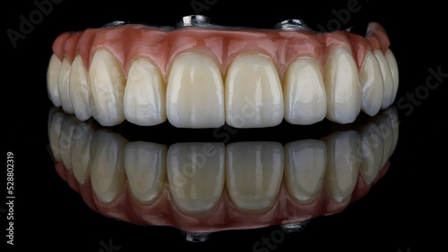 finished dental prosthesis made of zircon with natural gums on black glass with creative reflection