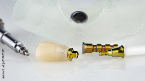 composition of dental crown, abutment and screwdriver on white background