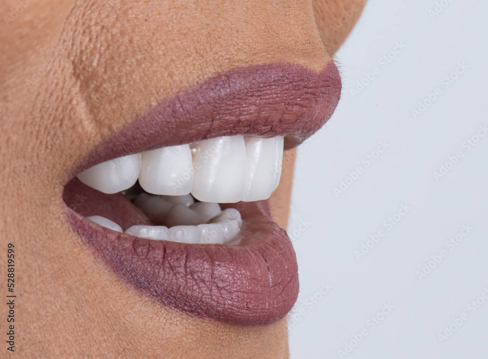 Obraz premium dental job photography, crowns veneers implants