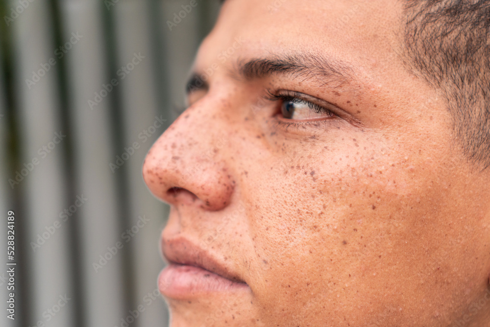 Fototapeta premium Close-up portrait of a man with freckles