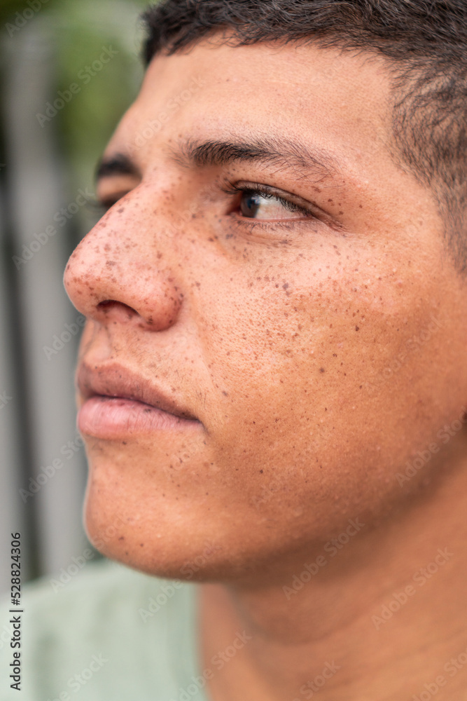 Close-up portrait of a man with freckles Close-up portrait of a man with freckles