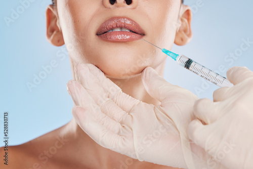 Beauty, collagen and a woman getting a lip injection from a medical worker. Plastic surgery, dermal filler and cosmetic treatment for youth. Modern medicine skincare and make up for natural good look