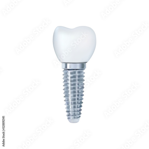 Dental implant on white background vector illustration