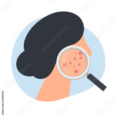 acne skin. Examination of the problematic skin of an aged woman through a magnifying glass