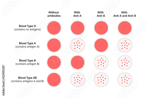 Blood typing of ABO blood types.