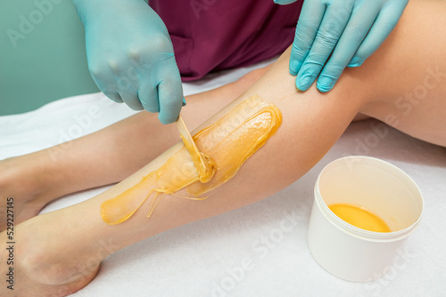 Woman undergoing leg hair removal procedure with sugaring paste in salon