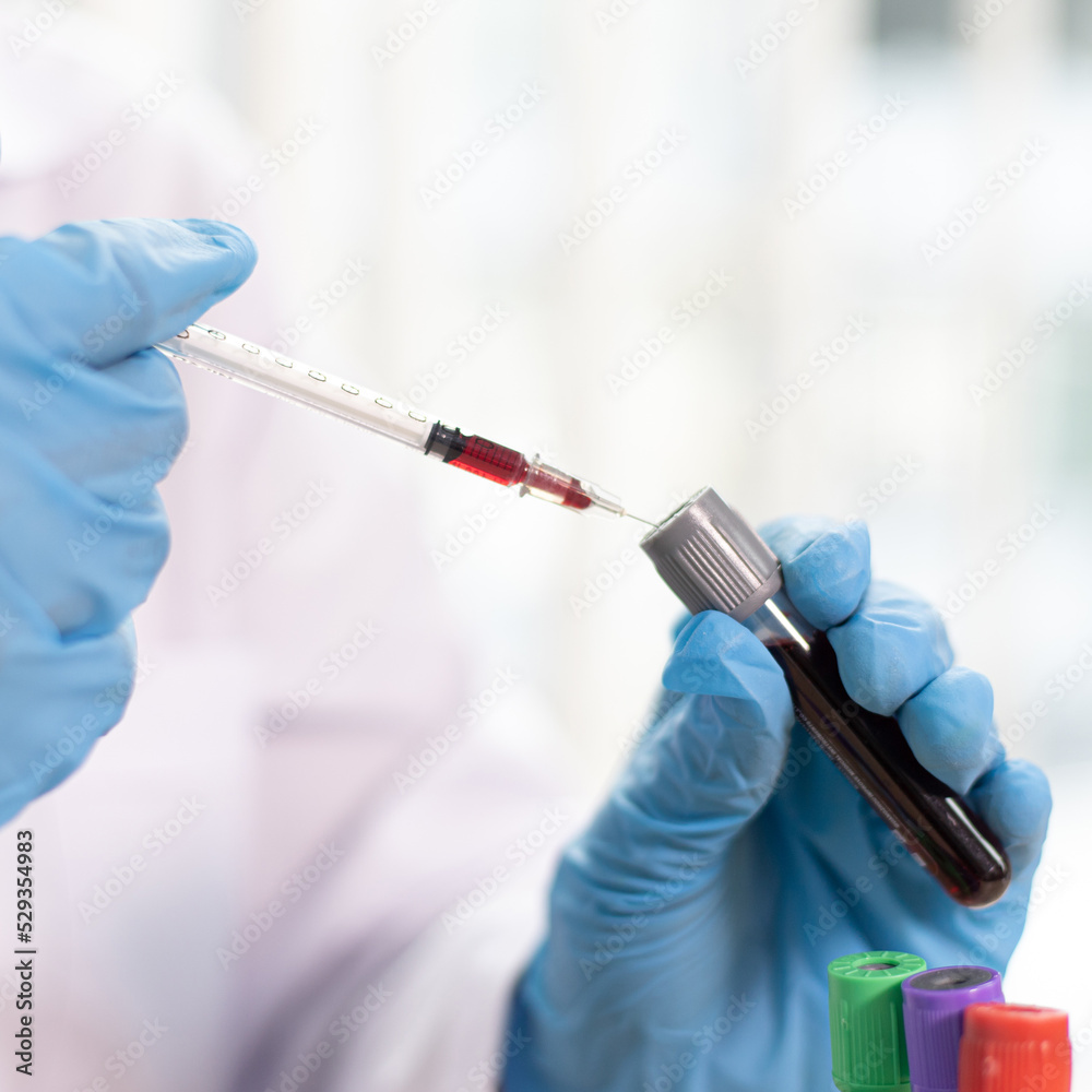 Scientists are testing antiretroviral drugs from the blood of infected patients in order to analyze antibiotics for normal treatment, Testing antiretroviral drugs or pathogens concept. Scientists are testing antiretroviral drugs from the blood of infected patients in order to analyze antibiotics for normal treatment, Testing antiretroviral drugs or pathogens concept.