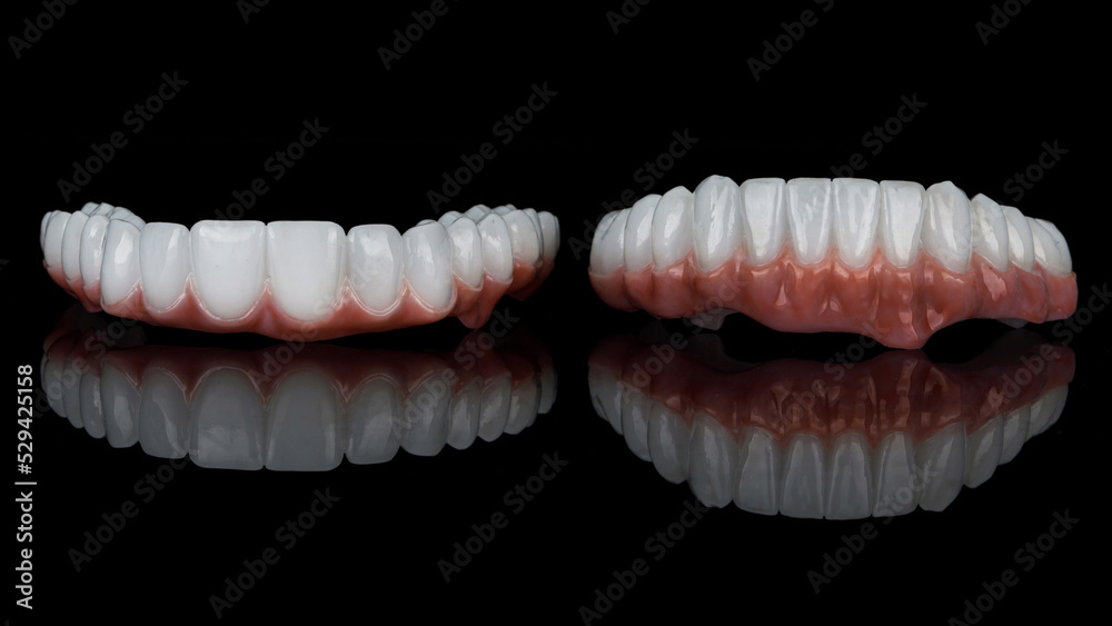 two excellent zircon dental prostheses on a black background with reflection two excellent zircon dental prostheses on a black background with reflection