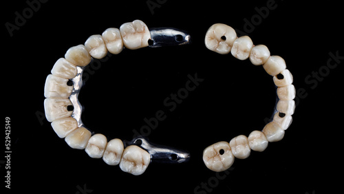 two dental prostheses on beams with ceramic crowns on a black background, top view
