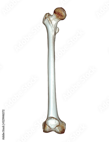 CT scan of Femur bone 3D . photo