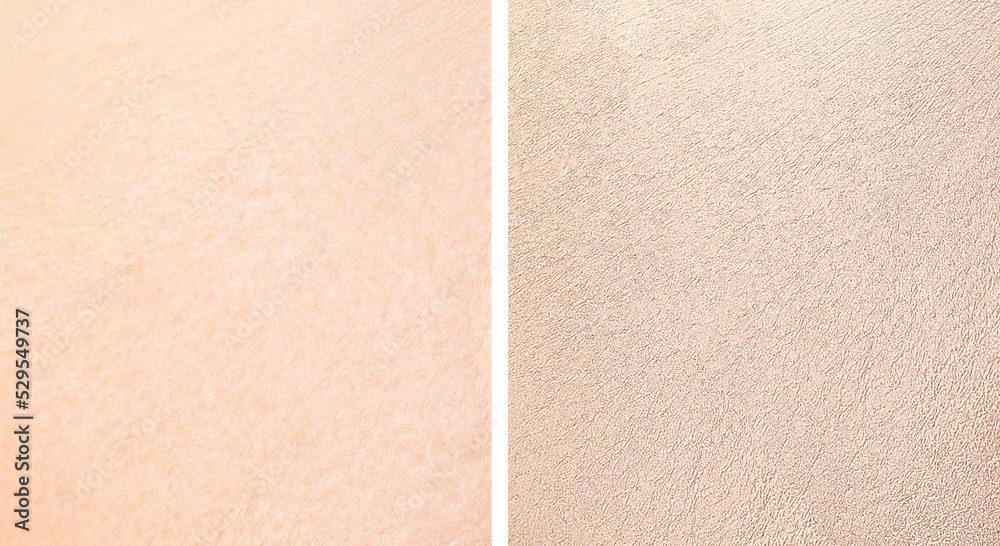 Fototapeta premium Collage with photos of dry and moisturized skin texture