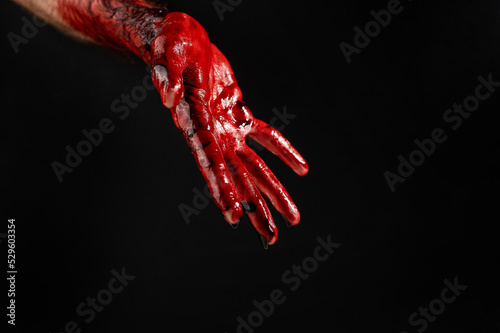 Close-up of a man's bloody palms on a black background.