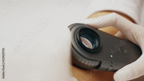 Close-up of dermatologist checking woman's birthmark.