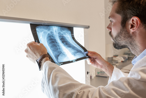  pulmonologist Doctor looks at a chest x-ray - clinic medical concept photo