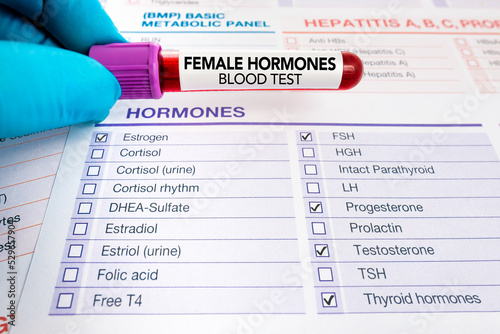 doctor holding blood sample for analysis of Female Hormones test. Requisition form with Blood test check for study of levels of hormones for woman