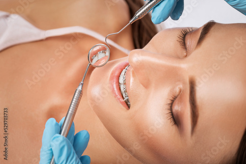 Dentist examining the braces of the system on the teeth of a young beautiful woman in a dental clinic. Correction of malocclusion. photo