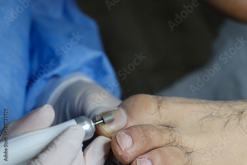 medical podiatry and podologist  pedicure
