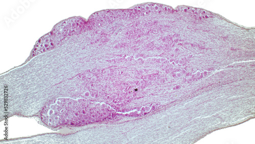 Pseudounipolar neurons. Dorsal root ganglion. Hematoxlyn and eosin stain. photo