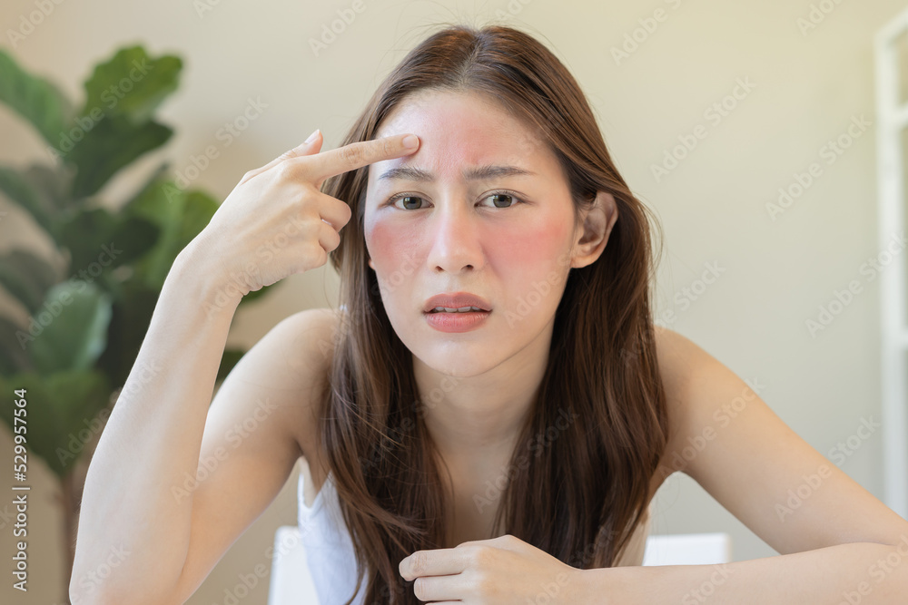 Dermatology, puberty asian young woman, girl looking into mirror, allergy presenting an allergic reaction from cosmetic, red spot or rash on face. Beauty care from skin problem by medical treatment. Dermatology, puberty asian young woman, girl looking into mirror, allergy presenting an allergic reaction from cosmetic, red spot or rash on face. Beauty care from skin problem by medical treatment.